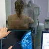 Ëmmer manner Fraen huelen um nationale Screeningprogramm fir Broschtkriibs Deel