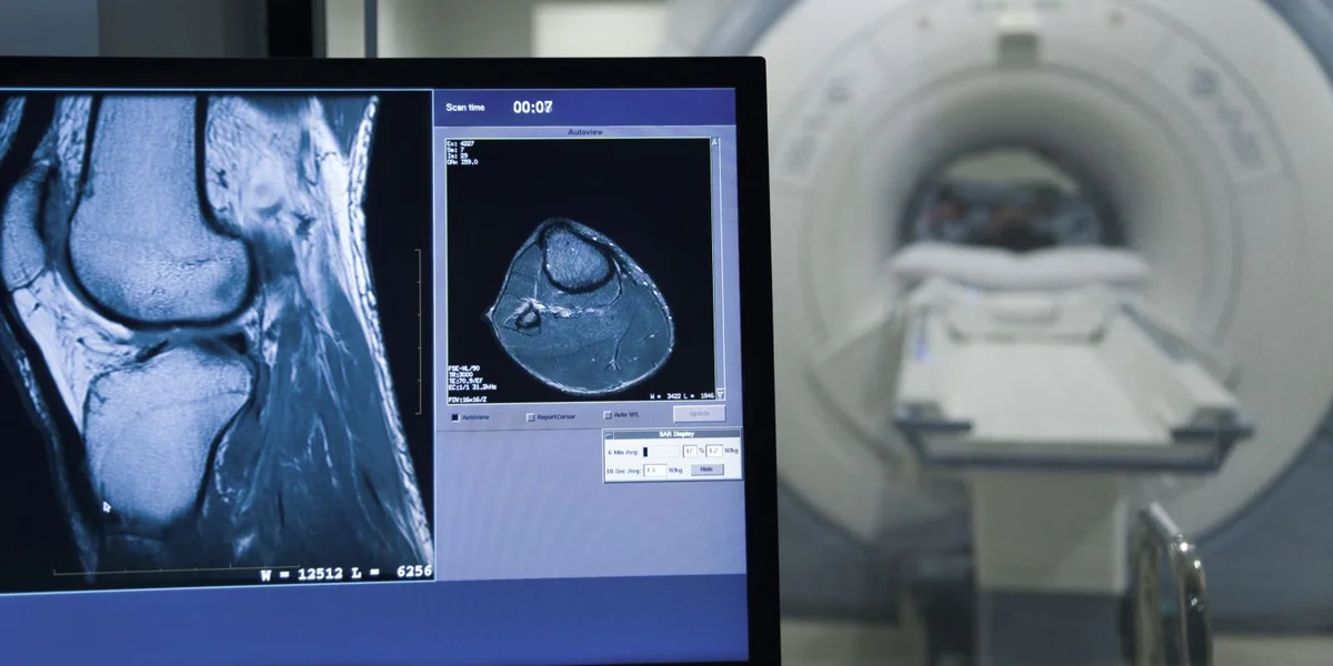 © picture alliance / PhotoAlto | Frédéric Cirou